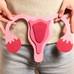 Deteksi Dini PCOS: Bagaimana Gaya Hidup Sehat Membantu Mengatasi Gejala?