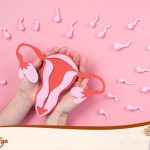 Kenapa Cewek Muda Rentan Kista? Ini Penyebabnya!